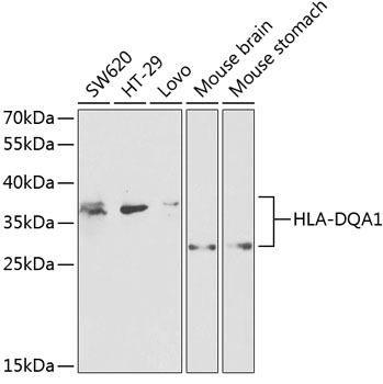 Anti-HLA-DQA1 Antibody (CAB2168)