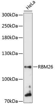 Anti-RBM26 Antibody (CAB13119)