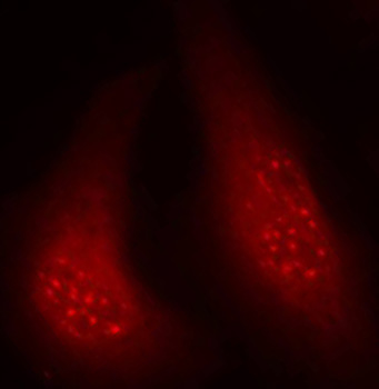 Anti-Phospho-P90RSK-T348 Antibody (CABP0166)