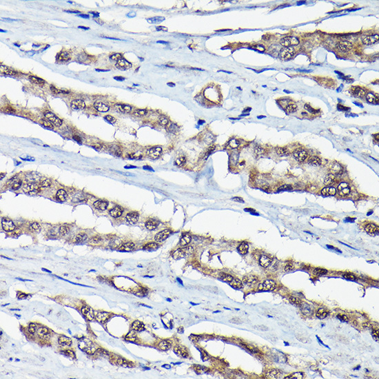 Anti-DDIT3 / CHOP Antibody (CAB6504)