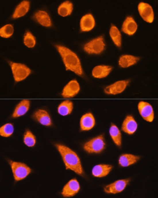 Anti-DAG1 Antibody (CAB10076)