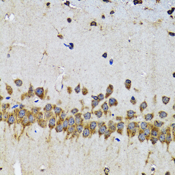 Anti-EFNB2 Antibody (CAB5669)