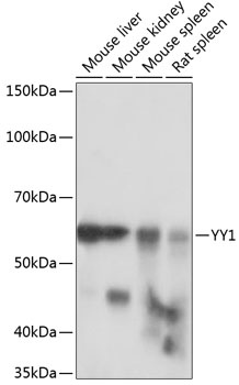 Anti-YY1 Antibody (CAB19569)