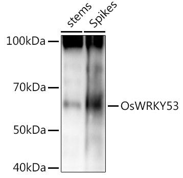 Western blot analysis of extracts of various tissues from the japonica rice (Oryza sativa L. ) variety Zhonghua 11, using OsWRKY53 antibody at 1:1000 dilution. Secondary antibody: HRP Goat Anti-Rabbit IgG (H+L) at 1:10000 dilution. Lysates/proteins: 25ug per lane. Blocking buffer: 3% nonfat dry milk in TBST. Detection: ECL Basic Kit. Exposure time: 30s.