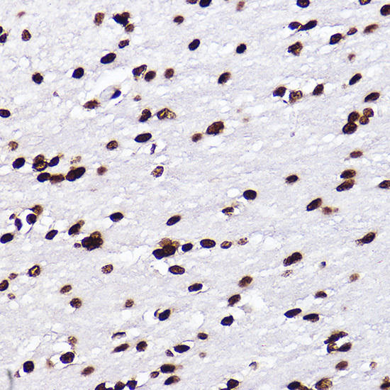 Immunofluorescence analysis of NIH/3T3 cells using MonoMethyl-Histone H3-K18 Rabbit mAb at dilution of 1:100 (40x lens). Blue: DAPI for nuclear staining.