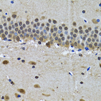 Anti-SPIN1 Antibody (CAB5853)