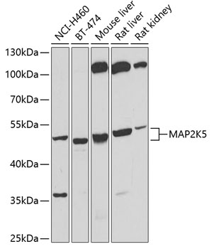 Anti-MAP2K5 Antibody (CAB6953)