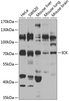 Anti-ICK Antibody (CAB7783)