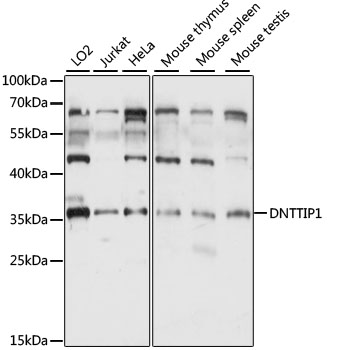 Anti-DNTTIP1 Antibody (CAB15558)