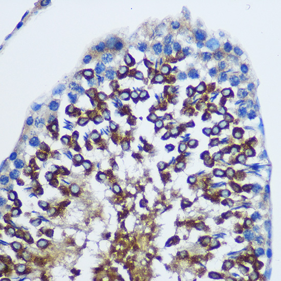 Anti-STAT4 Antibody (CAB2638)