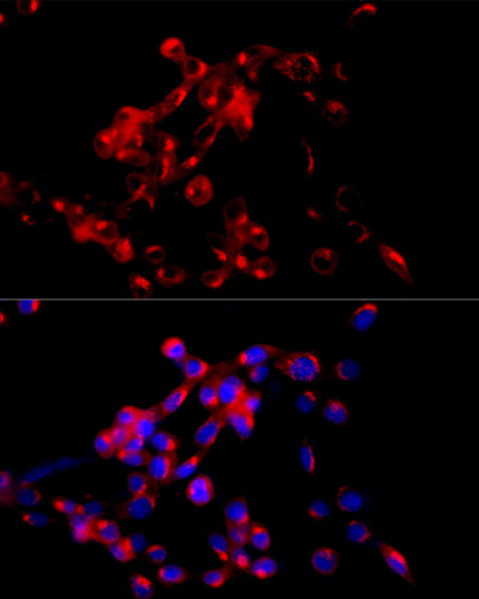 Anti-COPB2 Antibody (CAB7036)