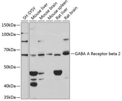 Anti-GABA A Receptor beta 2 Antibody