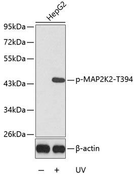 Anti-Phospho-MAP2K2-T394 Antibody (CABP0121)