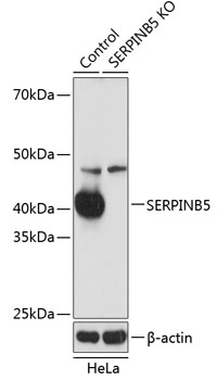 Anti-SERPINB5 Antibody [KO Validated] (CAB19847)