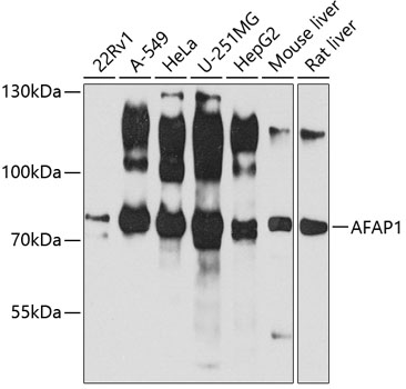 Anti-AFAP1 Antibody (CAB3478)