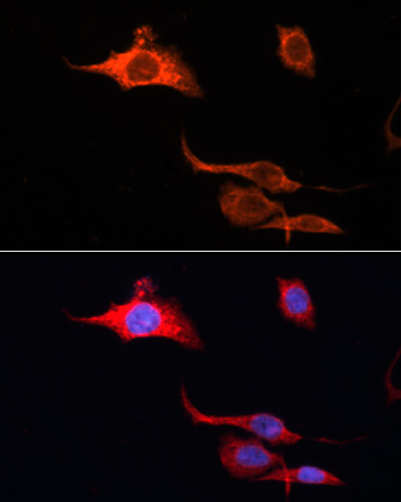 Anti-Alexa Fluor 555-conjugated Goat Anti-Rabbit IgG (H+L) Antibody