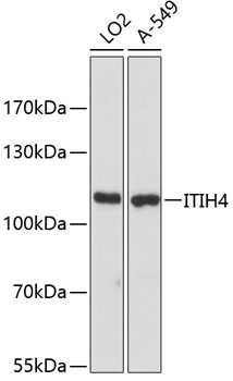 Anti-ITIH4 Antibody (CAB12807)