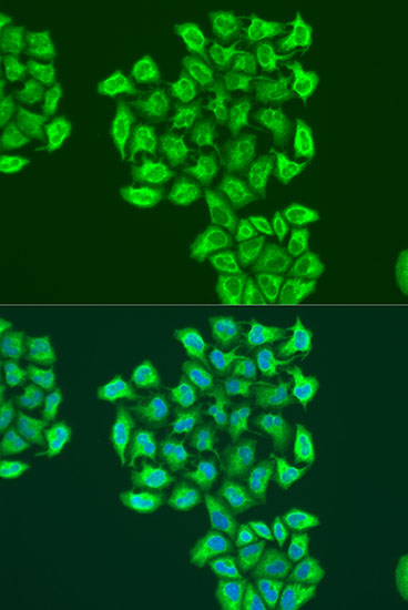 Anti-BNIP3 Antibody (CAB15032)