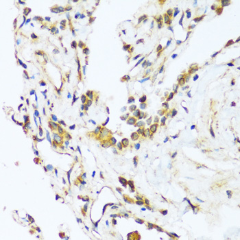 Anti-BAG3 Antibody (CAB14826)