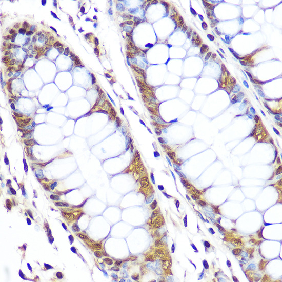 Anti-GAPDH Antibody (CABC001)