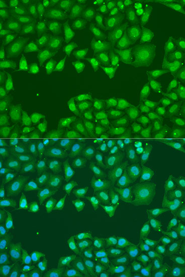 Anti-SSB Antibody (CAB0630)