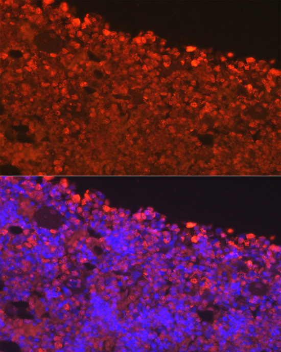 Anti-ELANE Antibody (CAB13015)