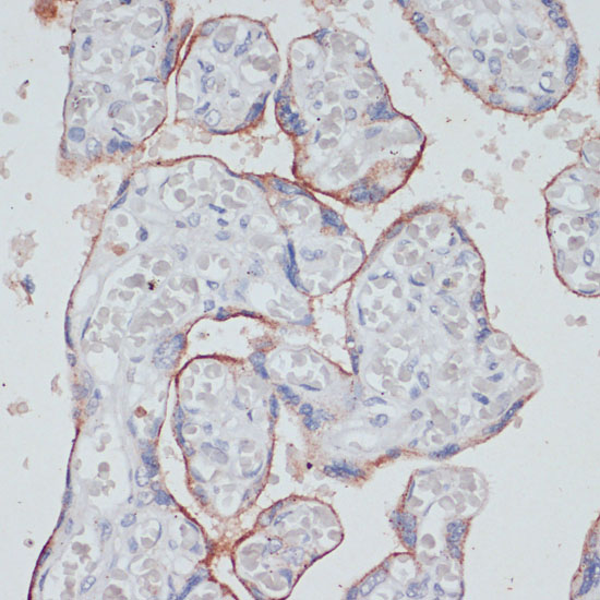 Anti-TFRC Antibody (CAB5865)