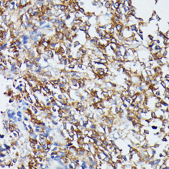 Anti-MAP2K5 Antibody (CAB6953)