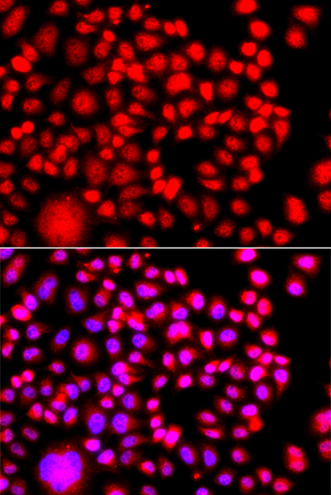 Anti-TESK2 Antibody (CAB13395)