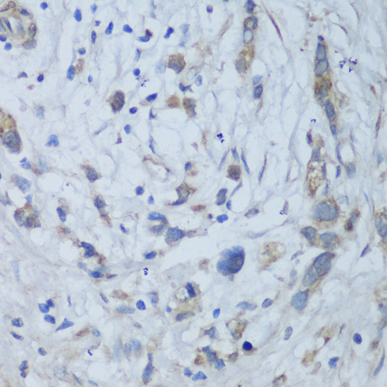 Anti-CEMIP Polyclonal Antibody (CAB8587)