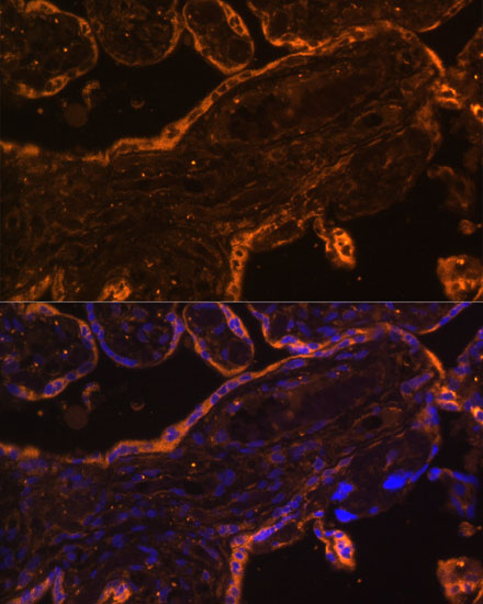 Anti-BRE Antibody (CAB15122)