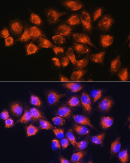 Anti-NPB Antibody (CAB16612)