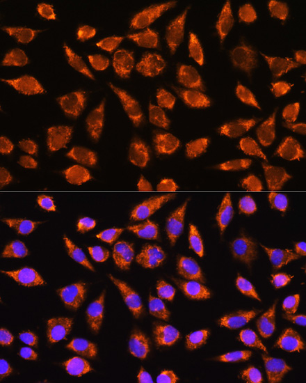 Anti-MARK2 Antibody (CAB16706)