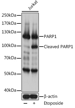 Anti-PARP1 Antibody [KO Validated] (CAB0942)