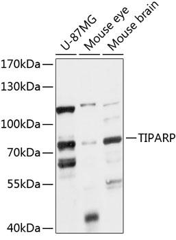 Anti-TIPARP Antibody (CAB14329)