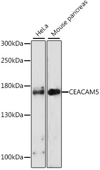 Anti-CEACAM5 Antibody (CAB0970)