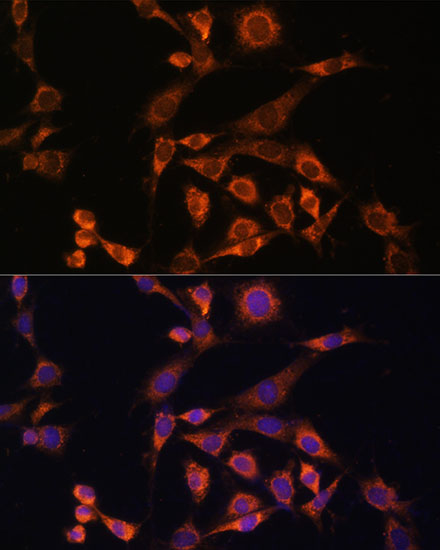 Anti-MAP2K2 Antibody [KO Validated] (CAB14770)