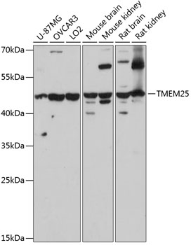 Anti-TMEM25 Antibody (CAB14370)