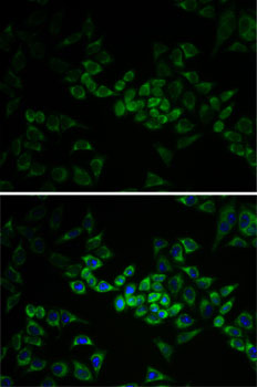 Anti-AK1 Antibody (CAB13460)