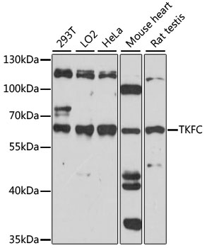 Anti-TKFC Antibody (CAB15421)