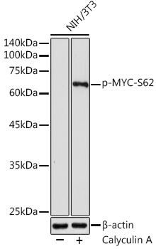 Anti-Phospho-MYC-S62 Antibody (CABP0082)