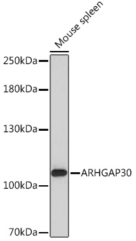 Anti-ARHGAP30 Antibody (CAB17847)