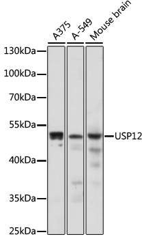 Anti-USP12 Antibody (CAB17862)