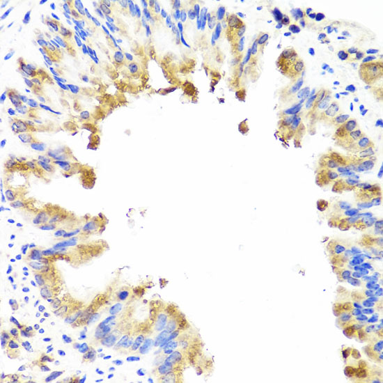 Anti-Ambra1 Antibody (CAB1083)