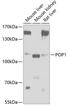 Anti-POP1 Antibody (CAB5961)