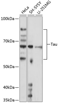 Anti-Tau Antibody (CAB19560)