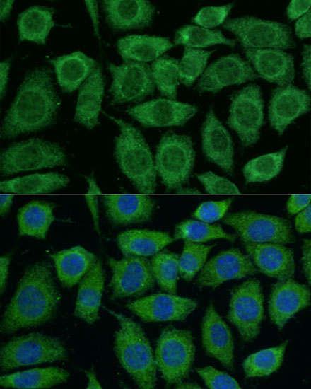 Anti-DLAT Antibody (CAB14530)