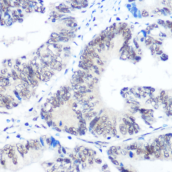 Anti-SNRPB Antibody (CAB2009)