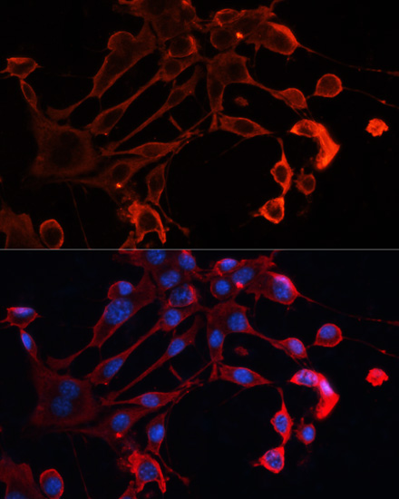 Anti-ADAM11 Antibody (CAB14249)