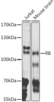 Anti-RB Antibody (CAB11409)